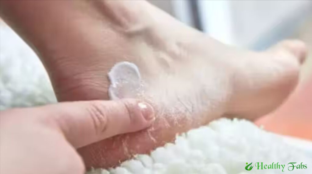 Natural Remedies for Cracked Heels